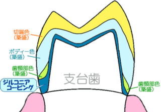 レイヤリング法 断面図